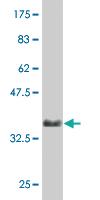 Anti-AKT2 Mouse Monoclonal Antibody [clone: 1F8]