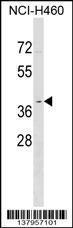 Anti-OR2Y1 Rabbit Polyclonal Antibody (AP (Alkaline Phosphatase))