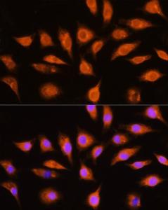 Immunofluorescence analysis of L929 cells using Anti-GNAI3 Antibody (A92943) at a dilution of 1:100 (40x lens) DAPI was used to stain the cell nuclei (blue)