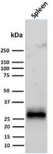 Western blot analysis of human spleen tissue lysate using Anti-HLA DRB Antibody [LN-3 + HLA-DRB/1067]