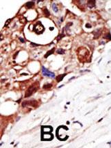 Anti-PIGK Rabbit Polyclonal Antibody