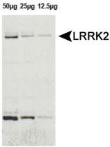 Anti-LRRK2 Rabbit Polyclonal Antibody