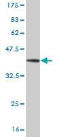 Anti-PROX1 Mouse Monoclonal Antibody [clone: 4D1]