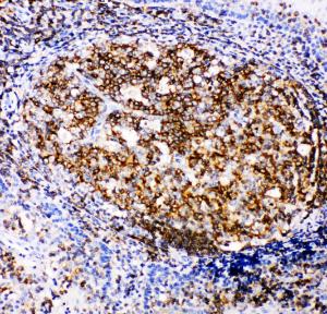 Anti-RIAM Rabbit Polyclonal Antibody