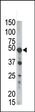 Anti-PIGK Rabbit Polyclonal Antibody