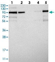 Anti-LRCH1 Rabbit Polyclonal Antibody