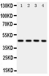 Anti-PDK2 Rabbit Polyclonal Antibody