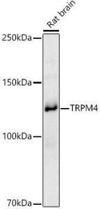 Western blot analysis of extracts of Rat brain, using Anti-TRPM4 Antibody (A8537) at 1:1,000 dilution. The secondary antibody was Goat Anti-Rabbit IgG H&L Antibody (HRP) at 1:10,000 dilution. Lysates/proteins were present at 25µg per lane.