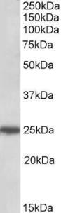 Anti-ARHGDIG Antibody (A84853) (05 µg/ml) staining of HeLa lysate (35 µg protein in RIPA buffer) Primary incubation was 1 hour Detected by chemiluminescence