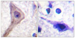 Immunohistochemical analysis of paraffin-embedded human brain tissue using Anti-Akt1 S1 Antibody. The right hand panel represents a negative control, where the Antibody was pre-incubated with the immunising peptide