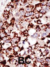 Anti-PIGK Rabbit Polyclonal Antibody