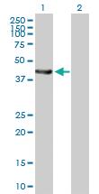 Anti-EPHX1 Mouse Polyclonal Antibody