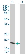 Anti-HSPB6 Mouse Polyclonal Antibody