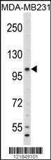 Anti-C6 Rabbit Polyclonal Antibody (AP (Alkaline Phosphatase))