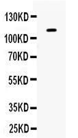 Anti-Eph receptor B1 Antibody