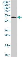 Anti-EPHX1 Mouse Polyclonal Antibody