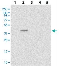 Anti-EYA4 Rabbit Polyclonal Antibody