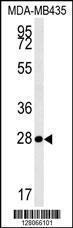 Anti-MRM1 Rabbit Polyclonal Antibody (APC (Allophycocyanin))