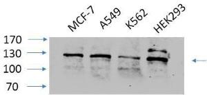 Anti-FAK Rabbit Polyclonal Antibody