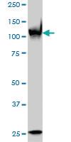 Anti-PARP1 Mouse Monoclonal Antibody [clone: 3G4]