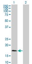 Anti-PLA2G12A Mouse Polyclonal Antibody