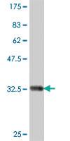 Anti-ATP6V0A1 Mouse Polyclonal Antibody