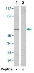 Anti-GK3P Rabbit Polyclonal Antibody