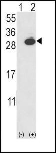 Anti-UCHL1 Rabbit Polyclonal Antibody (FITC (Fluorescein))