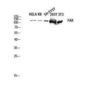 Anti-FAK Rabbit Polyclonal Antibody