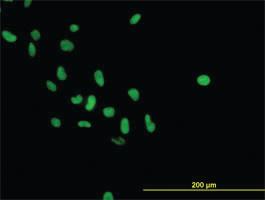 Anti-PARP1 Mouse Monoclonal Antibody [clone: 3G4]