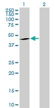 Anti-EPHX1 Rabbit Polyclonal Antibody