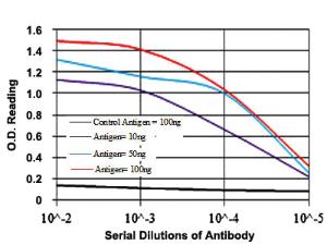 Anti-IL1B Mouse Monoclonal Antibody [clone: 3A6]