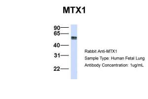 Anti-MTX1 Rabbit Polyclonal Antibody