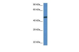 Anti-SMARCD3 Rabbit Polyclonal Antibody