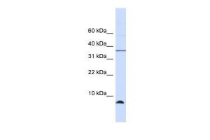 Anti-HSPE1 Rabbit Polyclonal Antibody