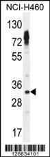 Anti-OR2Z1 Rabbit Polyclonal Antibody (AP (Alkaline Phosphatase))