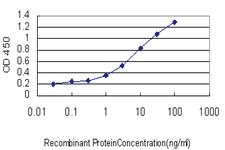 Anti-PARP1 Mouse Monoclonal Antibody [clone: 3G4]