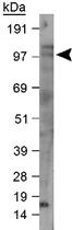 Anti-LRP8 Rabbit Polyclonal Antibody