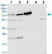 Anti-TOP1MT Rabbit Polyclonal Antibody