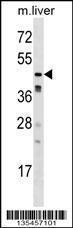 Anti-CAMK1G Rabbit Polyclonal Antibody (APC (Allophycocyanin))