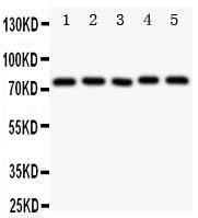 Anti-Tec Rabbit Polyclonal Antibody