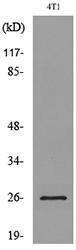 Anti-CD81 antibody