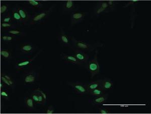 Anti-PARP1 Mouse Monoclonal Antibody [clone: 2C7]