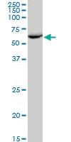 Anti-EPHX2 Mouse Polyclonal Antibody