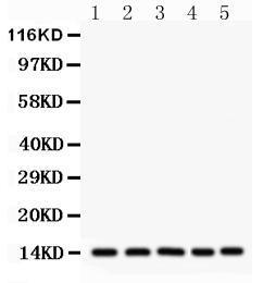 Anti-liver FABP Antibody