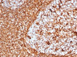 Antibody anti-cytokeratin 8 K88 100 µg