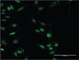 Anti-PARP1 Mouse Monoclonal Antibody [clone: 2C7]