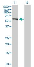 Anti-EPHX2 Mouse Polyclonal Antibody