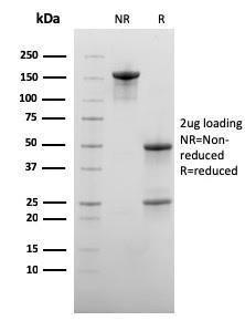 SDS-PAGE analysis of Anti-CD73 Antibody [NT5E/2545] under non-reduced and reduced conditions; showing intact IgG and intact heavy and light chains, respectively. SDS-PAGE analysis confirms the integrity and purity of the antibody.