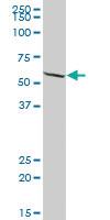 Anti-EPHX2 Mouse Polyclonal Antibody